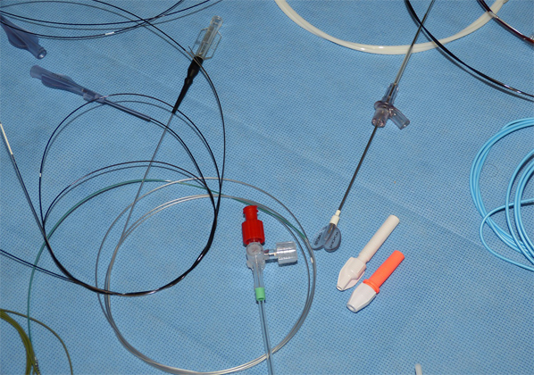 Terapi Arteri Perifer, Operasi Bypass atau Teknologi TurboHawk | OTC Digest